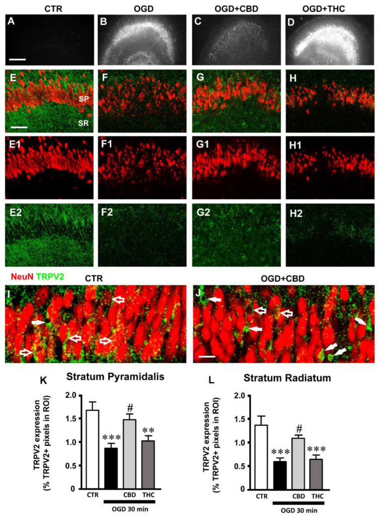 (A–D) Representative images of PI fluorescence in control (A), OGD (B), OGD + CBD, and OGD+ THC slices. Scale bar: 200 µm. (E–H2) Representative confocal images of immunostaining of neurons (NeuN, red) and TRPV2 channels (TRPV2, green) in CA1 SP and SR of CTR (E-E2), OGD (F–F2), OGD + CBD (G–G2), and OGD + THC (H–H2) slices. Images are z-projections of a single confocal z-scan captured with a 20× objective (total thickness: 1.2 µm). Scale bar: 75 µm. (I–J) Representative confocal images of immunostaining of neurons (NeuN, red) and TRPV2 channels (green) in CA1 SP of a CTR (I) and an OGD + CBD slice (J). Images are z-projections of a single confocal z-scan captured with a 40× objective (total thickness: 0.6 µm). Scale bar: 20 µm. (I) In CTR slices, the expression of TRPV2 was localized mainly on pyramidal neurons (open arrows). (J) In OGD + CBD slices, the expression of TRPV2 was localized mainly on non-neuronal cells (white arrows). (K) Quantitative analyses of TRPV2 channel expression in CA1 SP of CTR (n = 11), OGD (n = 10), OGD + CBD (n = 9), and OGD + THC slices (n = 9). Statistical analysis: one-way ANOVA p < 0.001; Newman–Keuls post hoc test *** p < 0.001 and ** p < 0.01 vs. CTR, # p < 0.05 vs. OGD. (L) Quantitative analyses of TRPV2 channel expression in CA1 SR of CTR (n = 12), OGD (n = 10), OGD + CBD (n = 8), and OGD + THC slices (n = 10). Statistical analysis: one-way ANOVA p < 0.001; Newman–Keuls post hoc test *** p < 0.001 vs. CTR, # p < 0.05 vs. OGD. Data reported in the graphs are expressed as the mean ± SEM.