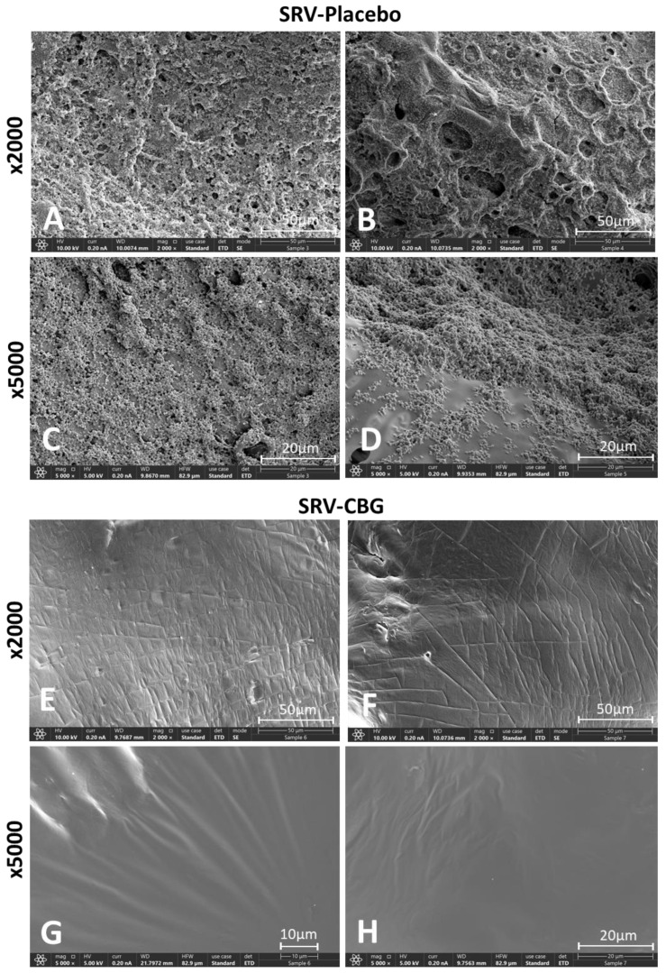 (A–H) HR-SEM images of SRV-placebo (A–D) and SRV-CBG-coated (E–H) mesh surfaces after 5 days of incubation with S. aureus. Magnifications of ×2000 (A,B,E,F) and ×5000 (C,D,G,H) are shown.