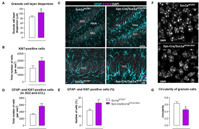 Double immunofluorescence analysis of Ki67 and GFAP in the hippocampal dentate gyrus, including representative immunofluorescence images, of Syn-Cre/Scn1aWT/A1783V mice compared with Scn1aWT/W animals at PND25. Values are means ± SEM of six animals per group. Data were assessed by the Student's t-test (*p < 0.05, **p < 0.01 vs. the control group). Scale bar for double labeling = 50 μm (top panels) and 20 μm (bottom panels).