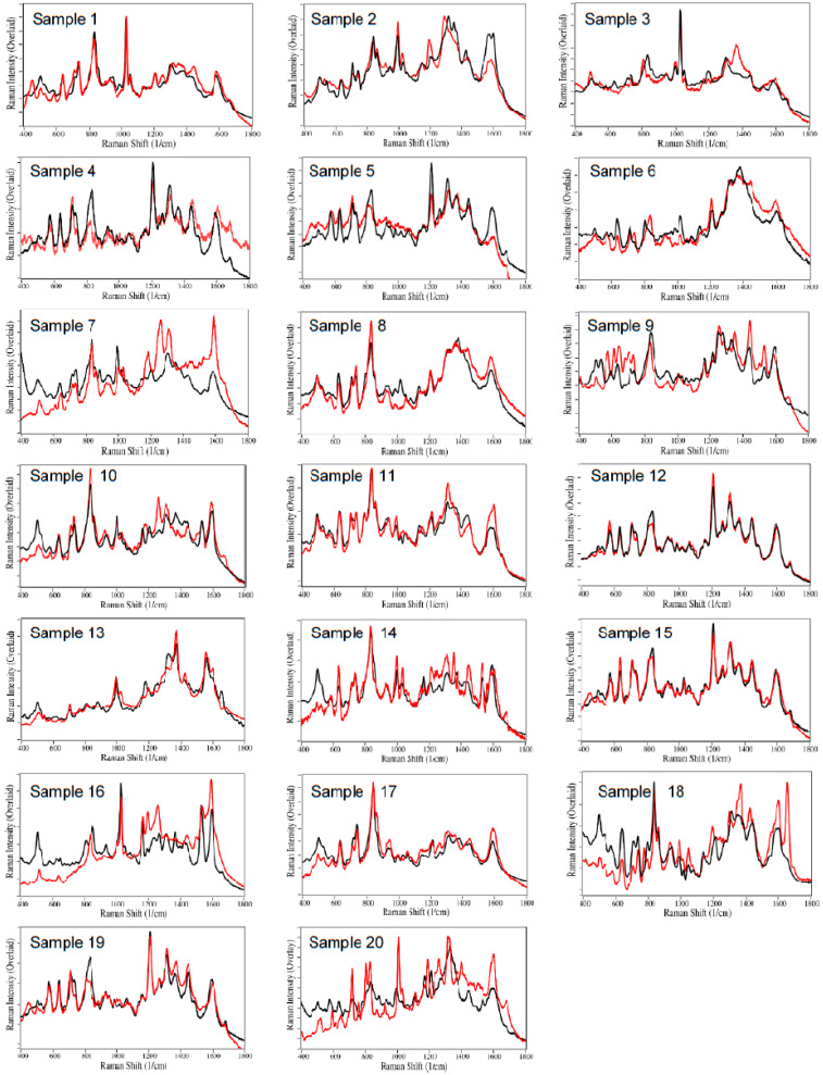 SERS of VACHS Samples 1 to 20. Actual spectra (red) are fit by the S-Quant software (black). Spectral conditions as in Figure 1.