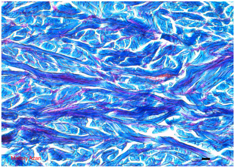 Dermis: Different features of the collagen fibers which histologically define the type of tissue considered. Light microscopy, Mallory Azan, scale bar = 10 μm [15].