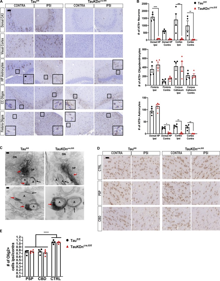 Oligodendroglial tau pathology propagation in TauKDncre;fl/fl mice. (A) AT8 IHC on PSP-tau–injected TauKDncre;fl/fl and Taufl/fl mice (n = 4 each) 6 mo p.i. Two independent experiments. CC, corpus callosum. Scale bars, 50 µm; inset, 10 µm. (B) Quantification of AT8+ neurons, oligodendrocytes, and astrocytes from A. Mean ± SEM plotted. One-way ANOVA for neurons, P = 0.0001; oligodendrocytes, P = 0.0029; astrocytes, P = 0.0001; post hoc analysis: *, P < 0.05, **, P < 0.01, ***, P < 0.001, ****, P < 0.0001. (C) Immuno-EM of AT8 in corpus callosum of CBD-tau–injected Taufl/fl and TauKDncre;fl/fl mice (n = 3 each) 3 mo p.i. Two independent experiments. ON, oligodendrocyte nucleus; OP, oligodendrocyte process; A, axon; red arrows, tau fibril; black arrows, myelin sheath. Scale bars, top, 200 nm; bottom, 100 nm. (D) Olig-2 IHC in the fimbria of CBD-tau, PSP-tau, and control-brain–injected TauKDncre;fl/fl and Taufl/fl mice (n = 4 mice each) 3 mo p.i. Two independent experiments. Scale bar, 25 µm. (E) Quantification of Olig-2+ cells from C. Mean ± SEM plotted. One-way ANOVA with Bonferroni post hoc P < 0.0001; post hoc: *, P < 0.05, **, P < 0.01, ***, P < 0.001.