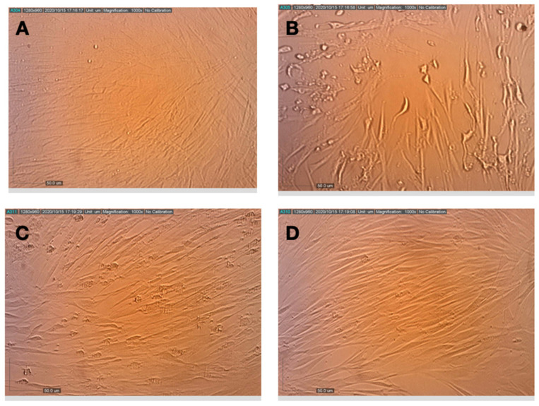 Effects of pretreatment of MRC-5 cells with terpenes and CBD on the replication and cytopathic effect of HCoV-229E. (A) Healthy MRC-5 cells, (B) MRC-5 cells that had been pretreated with assay medium, photographed 72 h after inoculation with HCoV-229E, (C) MRC-5 cells that had been pretreated with terpenes, photographed 72 h after infection with HCoV-229E, (D) MRC-5 cells that had been pretreated with terpenes and CBD, photographed at 72 h after infection with HCoV-229E.