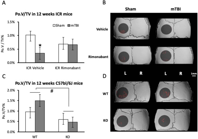 Strain-dependent role of CB1 in calvarial porosity at steady-state and following mTBI. Calvarial porosity (PoV/TV) in the left parietal bone 10 days after mTBI on the right side in 12-week old male mice. (A,B) ICR mice treated with Rimonabant or vehicle. (C,D) C57Bl/6J WT and CB1−/− mice. (A) Graphs represent mean ± SD in 6 animals per group. *p = 0.039, vs Sham. (C) Graphs represent mean ± SD in 5 animals per group except n = 8 in the WT sham group. #p = 0.014, KO vs WT, 2-way ANOVA) and (B,D) µCT representative images. Color coded as described in Fig. 1.