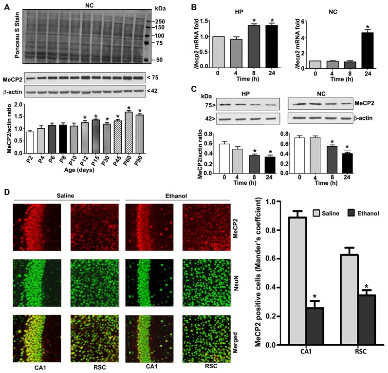 MeCP2 protein expression pattern during mouse brain development; ethanol treatment of P7 mice enhances Mecp2 mRNA but impairs the protein levels in the HP and NC regions. (A) MeCP2 protein expression pattern during mouse brain development. The MeCP2 expression pattern in neocortical nuclear protein extract obtained from P2 to P90 mouse brains were subjected to western blotting. Equal protein loading was confirmed after Ponceau S staining, and β-actin was used as the protein loading control. (*p < 0.01 vs P2 groups; n = 12 pups/group). (B) RT-qPCR analysis of Mecp2 mRNA in HP and NC extracts obtained 4–24 h after the first saline or ethanol injection (n = 12 pups/group). Gapdh mRNA was used as the internal control for normalization of Mecp2 mRNA levels. (C) Western blot analysis of MeCP2 proteins in the P7 HP and NC nuclear protein extracts (4–24 h after the first saline or ethanol treatment). β-actin was used as the protein loading control. In the 0 h ethanol group, saline was injected [*p < 0.01 vs. saline (0 h) group]. (n = 12 pups/group). (D) The coronal brain sections (HP, hippocampus, and RSC, retrosplenial cortex; saline and 8 h ethanol) were used for immunohistochemistry with anti-mouse MeCP2 and anti-rabbit NeuN antibodies to label MeCP2-positive NeuN in neurons. Mander’s coefficient analysis was used to evaluate MeCP2-positive NeuN neurons in the CA1 and RSC brain regions. Error bars, SEM (*p < 0.01 vs. Saline, n = 6 pups/group). Scale bars = 10 μm. Error bars, SEM (one-way ANOVA with Bonferroni’s post hoc test).