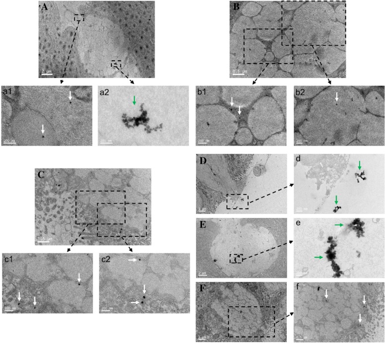 Distribution of triangular silver nanoplates in intestinal GCs of mice with CBD ligation. The CBD ligation mice group was treated with triangular silver nanoplates injected via tail vein 7 days after ligation. Intestinal GCs of different intestinal tissues. A Duodenum, triangular silver nanoplates were shown in an aggregation mode (green arrow), while some triangular sliver nanoplates were in a dispersion mode (white arrows). B Jejunum, triangular silver nanoplates located at the intestinal GC (white arrows). C Ileum and some triangular silver nanoplates were excreted out, while some were still inside. D Colon, some triangular silver nanoplates were secreted out and into the gut. E, F Rectum, some triangular silver nanoplates were ready to excrete out (dispersion mode, white arrows), while others were still inside (aggregation mode, white arrow)