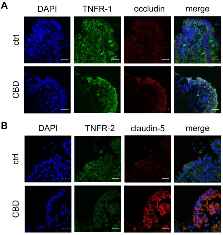Confocal laser microscopy images of TNF receptors and tight junction proteins in Peyer’s Patch (PP) after incubation with 40 µM of CBD for 6 h. Immunofluorescent staining of (A) TNFR-1 (green) and occludin (red), (B) TNFR-2 (green) and claudin-5 (red). Nuclei were stained in blue (DAPI; scale bar: 20 μm; n = 7; representative images).