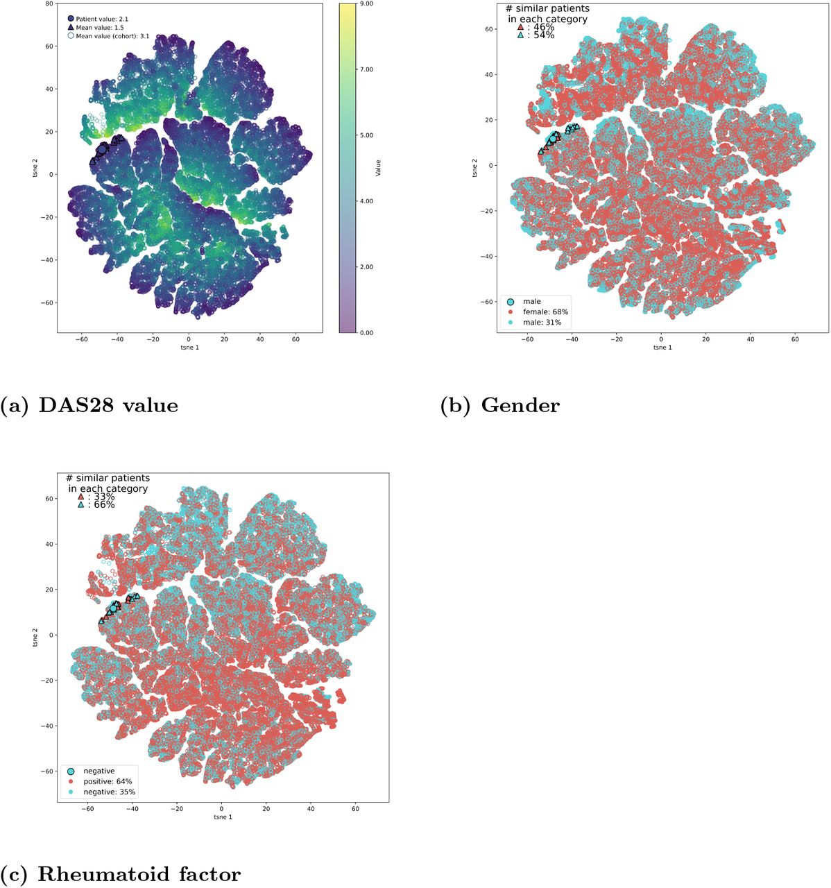 The patient’s rheumatoid factor status and their low DAS28 value can be observed among nearest neighbours subset as well.