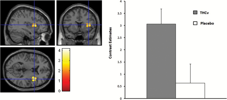 Left: Strawberry sight. Increased insula activation under tetrahydrocannabivarin (THCv) compared with placebo, small volume corrected (svc) (z=3.46, P=.005 svc family wise error [FWE]-corrected for multiple comparisons). Right: Contrast estimates for insula centered at 38 10 10 for strawberry sight. Error bars show 1 SEM.