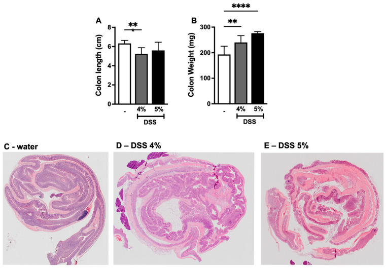 DSS administration decreases colon length and increases colon weight. (A) Colon length and (B) colon weight from mice given either water or DSS 4% or DSS 5%. Hematoxyline and eosin staining of colon tissues of mice administered either (C) water, (D) DSS 4%, or (E) DSS 5%. Data are represented as means ± SEMs; N = 8–10 (water and DSS 4%) and 5 (DSS 5%). White bar indicates mice given water only. ** p < 0.01, and **** p < 0.0001 using one-way ANOVA with a post hoc analysis.
