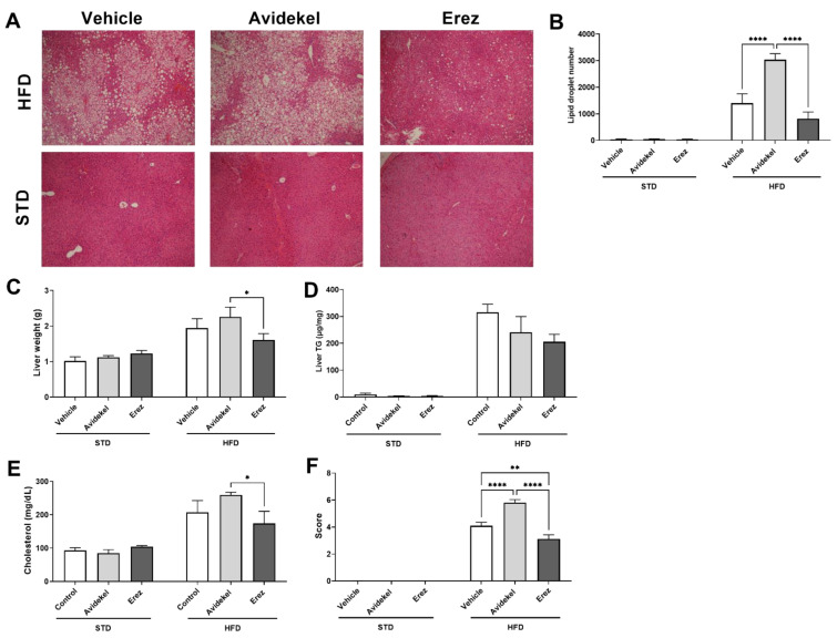 Effect of Avidekel and Erez extract on obesity-induced steatosis. (A). Representative liver tissue sections stained with H&E (magnification ×100). (B). Morphological analysis of liver droplet density (n = 5). (C). Liver weights. (D). Levels of hepatic triglycerides (n = 3). (E). Serum cholesterol (n = 3). (F). Severity of steatosis was blindly scored as described by Liang et al. [27] (n = 3). Data are shown as mean ± SEM. * p < 0.05, ** p < 0.002, **** p < 0.0001. Statistical significance was determined by using two-way ANOVA followed by Tukey’s post hoc test.