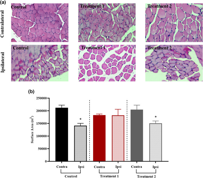Effect of treatment on the muscle fibers morphology. (a) Representative photographs of the Tibialis anterior muscle cross‐section were viewed under a compound microscope; H&E stained images taken at 40×. (b) Muscle fibers morphology showed a remarkable improvement (*p = .013) in treatment 1 group. In contrast, a nonsignificant difference (p > .999) was noted in treatment 2 and control group animals.