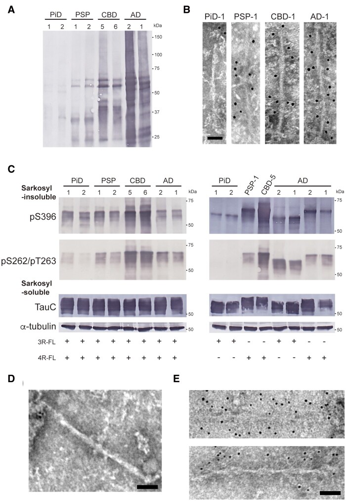 Phosphorylation at Ser262 in insoluble tau extracted from SH-SY5Y cells transfected with patient-derived tau strains. (A) Immunoblot analysis with pS262/pT263 antibody of sarkosyl-insoluble fractions prepared from brains of tauopathy patients. Insoluble tau derived from PSP, CBD, and Alzheimer’s disease cases shows pS262-positive bands, while insoluble tau derived from PiD cases is pS262-negative. Full-length blots are presented in the Supplementary material. (B) Immunoelectron microscopy of sarkosyl-insoluble fractions extracted from PiD, PSP, CBD and Alzheimer’s disease patients’ brains. Electron micrographs show fibrous structures derived from PiD negative for pSer262/pT263 antibody and fibrous structures derived from PSP, CBD and Alzheimer’s disease positive for pSer262/pT263 antibody, labelled with secondary antibody conjugated to 10 nm gold particles. Scale bar = 50 nm. (C) Sarkosyl-insoluble fractions extracted from patients’ brains (1 μl) were introduced into SH-SY5Y cells transiently co-expressing HA-tagged human tau 3R1N and 4R1N (left), and expressing HA-tagged human tau 3R1N or 4R1N (right). Immunoblot analysis of sarkosyl-insoluble fractions and sarkosyl-soluble fractions extracted from mock-transfected cells, and cells with introduced sarkosyl-insoluble fractions from two PiD cases, two PSP cases, two CBD cases and two Alzheimer’s disease cases. Insoluble tau was detected with pS396 and pS262/pT263 antibodies. Total tau was detected with TauC antibody. Full-length blots are presented in the Supplementary material. (D) Immunoelectron microscopy of sarkosyl-insoluble fractions extracted from transfected cells with PiD-tau seeds. Fibrous structure negative for pS262/pT263 antibody is shown. Scale bar = 50 nm. (E) Immunoelectron microscopy of sarkosyl-insoluble fractions extracted from transfected cells with AD-tau seeds. PHF-like tau structures positive for pS262/pT263 antibody, labelled with secondary antibody conjugated to 10 nm gold particles. Scale bar = 50 nm.