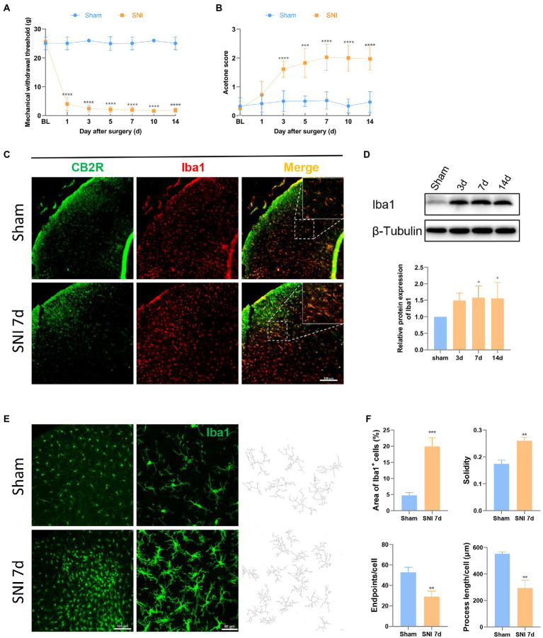 SNI induced hyperalgesia changed the expression and morphology of microglia in the spinal dorsal horn. (A,B) SNI significantly reduced the MWT (A) and improved the acetone score (B) in the ipsilateral paws. (****p < 0.0001 compared with the sham group, n = 12 in each group). (C) Double immunofluorescence of CB2R and Iba1 in the spinal cord of sham and SNI-7d rats. The fluorescence images in the boxes were magnified to better display the double staining. Scale bar, 100 μm. (D) The expression of Iba1 increased on days 3, 7, and 14 after SNI. (*p < 0.05 compared with the sham group, n = 6 in each group). (E) microglia micrographs from the ipsilateral spinal dorsal horn sham or SNI-7d rats. The images with higher magnification were skeletonized and expressed as black-and-white images (right side) for measuring the three parameters. Scale bars, 100 μm for lower magnification and 50 μm for higher magnification. (F) Quantification of the area of Iba1+ cells and morphology of microglia. Solidity, the area of cell body / the area of processes for each cell. Results for each group were obtained from three rats and three micrographs from each sample. The average values of each sample were taken for statistics. (**p < 0.01, ***p < 0.001 compared with the sham group).