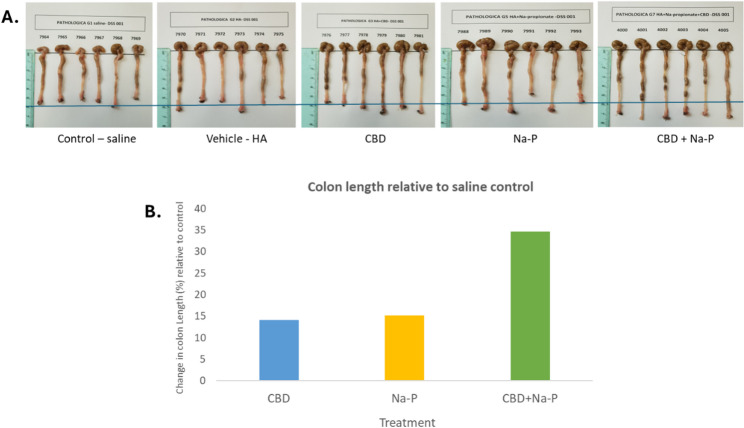 Colon length measured on Day 11. A Representative images of excised colons. B Quantitative analysis expressed as percentage change relative to saline control. The CBD+Na-P group demonstrated the greatest preservation of colon length. Statistical analysis was performed using one-way ANOVA