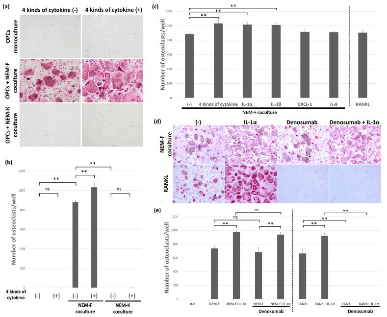 Characterization of selected inflammatory cytokines on stimulation or induction of osteoclastogenesis. (a) Representative views of TRAP staining 5 days after the coculture of NEM-F or NEM-K cells with OPCs with or without supplementation of a mixture of IL-1α, IL-1β, IL-8, and CXCL1 and 5 days after the culture of OPCs with or without supplementation of a mixture of IL-1α, IL-1β, IL-8, and CXCL1. (b) The number of osteoclasts 5 days after the coculture of NEM-F or NEM-K cells with OPCs with or without supplementation of a mixture of IL-1α, IL-1β, IL-8, and CXCL1 and 5 days after the culture of OPCs with or without supplementation of a mixture of IL-1α, IL-1β, IL-8, and CXCL1. ** p < 0.01, ns: not significant (one-way ANOVA with the Tukey–Kramer method). (c) Quantitative data on the number of osteoclasts 5 days after the coculture of NEM-F cells with OPCs supplemented with each inflammatory cytokine. ** p < 0.01 (one-way ANOVA with the Tukey–Kramer method). (d) Evaluation of the effects of denosumab on osteoclastogenesis induced by the coculture of NEM-F cells with OPCs or OPCs cultured with RANKL with or without supplementation of IL-1α. Representative views of TRAP staining after 5 days of coculture. (e) Quantitative data on the number of osteoclasts induced by the coculture of NEM-F cells with OPCs or OPCs cultured with RANKL with or without supplementation of IL-1α and further supplementation of denosumab. ** p < 0.01, ns: not significant (one-way ANOVA with the Tukey–Kramer method).