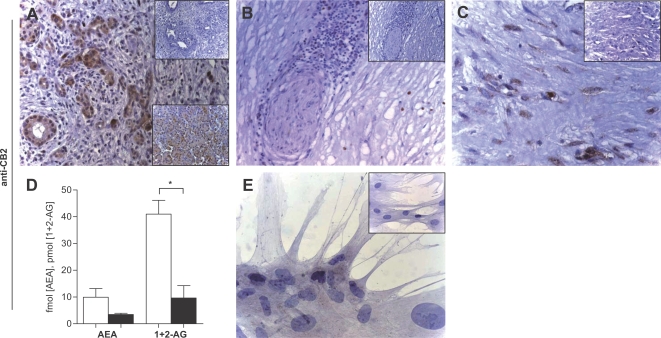 Cannabinoid receptor 2 and endocannabinoid levels in chronic pancreatitis.Using an anti-CB2 antibody, tubular complexes were strongly stained (A). Invading mononuclear cells were also immunopositive (B), whereas intrapancreatic nerves were mostly unstained or only faintly positive (B). Pancreatic stellate cells were immunopositive for CB2 (C). The endocannabinoids anandamide (AEA) and 1+2-arachidonoylglycerol (1+2-AG) were lower in chronic pancreatitis (AEA: p = 0.14 and 1+2-AG: p = 0.0066; D). Cultured pancreatic stellate cells were faintly CB2-immunopositive (E). Original magnification: x20 (A, B), x40 (C), x80 (F). Insets: negative controls. Lower insets (A): CB2 in normal pancreas.