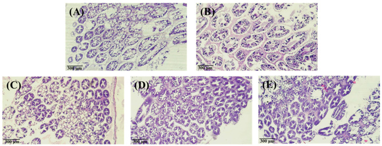 Inverted micrographs of H&E-stained hepatopancreas of white shrimp that containing (A) control at 0 h; (B) control at 240 h; (C) injection 50 µg (g shrimp)−1 PNWE at 240 h; (D) injection 100 µg (g shrimp)−1 PNWE at 240 h; (E) injection 200 µg (g shrimp)−1 PNWE at 240 h. (100×).