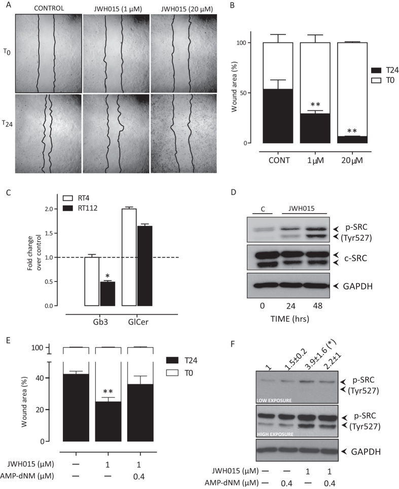 Effect of JWH015 treatment in high-motility RT112 cells.Panels A: Representative images of RT112 wound healing assay evaluated 24 hours post scratch. Wound edges were artificially highlighted by drawing a black line. Panel B: Cell migration was quantified as % of cell-covered area at 24 hours (black bars) compared to the cell-free wound area at time 0 (white bars). Data are the mean ± sd of three independent experiments in triplicate. **p < 0.01 vs T0, 1-way ANOVA, Dunnett’s post test. Panel C: Levels of SL (Gb3, and GlcCer) in RT4 and RT112 cells 24 h after JWH015 (1 μM) exposure. Data are the mean ± sd of three independent experiments and expressed as fold change over the level measured in untreated cells (indicated by the dashed line). *P < 0.05 vs RT4, 1-way ANOVA, Dunnett’s post test. Panel D: immunoblot analysis of inactive c-Src (pSRC Tyr527) 24 and 48 hours after JWH015 (1 μM) exposure in RT112 cells. Similar results were obtained in two other independent experiments. Panel E: Effect of SL synthesis inhibition by AMP-dNM (0.4 μM) on cell migration of RT112 treated with JWH015 (1 μM); data are the % (mean ± sd, n = 4)of re-populated scratched area. Panel K: Immunoblot analysis of inactive c-Src (pSRC Tyr527) in RT112 cells treated with JWH015 (1 μM), with or without AMP-dNM (0.4 μM). The calculated fold-increase of band density (mean ± sd, n = 4) is shown above the panel. Both low and high exposure blots are shown.