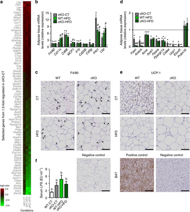 Adipose tissue Napepld deletion induces inflammation and altered metabolism in SAT.(a) Heat map from microarray analysis representing selected genes involved in inflammation or lipid metabolism, based on the list of genes down or upregulated 1.5-fold in cKO-CT versus WT-CT mice. See also Supplementary Fig. 4 and Supplementary Data 1. (b) mRNA expression of adipose tissue inflammation markers measured by RT–qPCR (n=20–27 for F4/80, Cd11c, MCP1 and Il1b and n=6–10 for the other markers). The black-dotted line represents the WT-CT levels for mRNA expression. Data in b regarding inflammatory markers correspond to the results of three independent experiments. (c) Representative pictures of staining for F4/80 in SAT. Scale bar, 100 μm. (n=6–10). See also Supplementary Fig. 5. (d) mRNA expression of adipose tissue metabolism markers measured by RT–qPCR (n=6–10). The black-dotted line represents the WT-CT levels for mRNA expression. (e) Representative images of staining for UCP1 in SAT. Scale bar, 100 μm. (n=6–10). See also Supplementary Fig. 5. (f) Plasma LPS levels (EU per ml) measured in the portal vein (n=6–10). Data are presented as the mean±s.e.m. Data with different superscript letters are significantly different (P<0.05) according to post-hoc one-way analysis of variance. ‘*’ indicates a significant difference (P<0.05) versus WT-CT, and ‘#’ indicates a significant difference (P<0.05) versus WT-CT and cKO-CT according to post-hoc one-way analysis of variance.