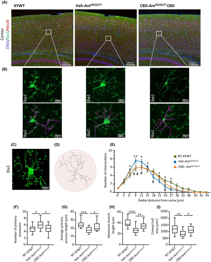 Analysis of microglia morphology in the cortex of XYWT, vehicle (Veh)‐treated Arx (GCG)7/Y, and cannabidiol (CBD)‐treated Arx (GCG)7/Y. (A, B) Representative confocal micrographs images of Iba1‐positive cells in the cortical subfield of control, Veh‐treated Arx (GCG)7/Y, and CBD‐treated Arx (GCG)7/Y mice. Scale bars = 100 μm (A) and 10 μm (B). (C, D) Representative images of cortical Iba1‐positive microglial cell converted to a maximum intensity Z‐stack projection and corresponding binary image created by thresholding with concentric radii imposed upon cells at 3‐μm intervals for the Sholl analysis. Scale bar = 10 μm. (E) Sholl analysis of the number of intersections of microglial processes with a series of concentric circles centered on the soma of each cell in control, Veh‐treated Arx (GCG)7/Y, and CBD‐treated Arx (GCG)7/Y mice. The branching profile of microglia from Veh‐treated Arx (GCG)7/Y mice—compared to the XYWT and Arx (GCG)7/Y CBD profiles—is shifted upward near the soma and leftward in the distal region of the soma. CBD, CBD treatment; NT, no treatment; Veh, Veh treatment. Differences were assessed using two‐way analysis of variance (ANOVA) with Tukey multiple comparisons: XYWT versus Veh‐treated Arx (GCG)7/Y *p < .05, **p < .005; Veh‐treated Arx (GCG)7/Y versus CBD‐treated Arx (GCG)7/Y #p < .05, ##p < .005. (F–I) Analysis of primary processes, average of primary process length, maximum of branch length, and convex hull area. Cells numbered n = 18 for XYWT, n = 19 for Veh‐treated Arx (GCG)7/Y, and n = 18 for CBD‐treated Arx (GCG)7/Y. Differences were assessed using two‐way ANOVA with Tukey multiple comparisons: *p < .05, ** < .005, ***p < .002.