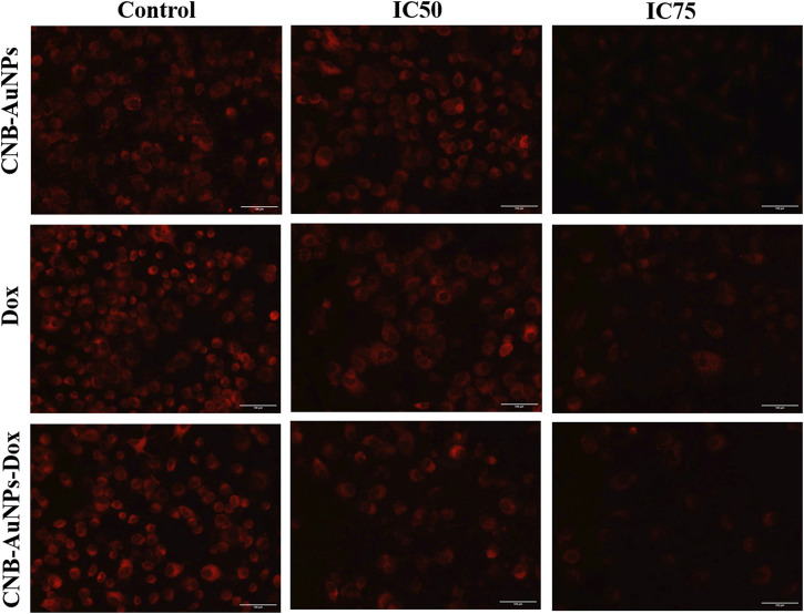 Qualitative assessment of Mitochondrial Membrane Potential in Mitotracker Red-stained A549 cell treated with IC50 and IC75 of CNB-AuNPs-Dox, Dox, and CNB-AuNPs for 24 h analyzed by fluorescence microscopy. The images shown are representative of three independent experiments (Scale bar: 100 μm; Magnification: ×20).