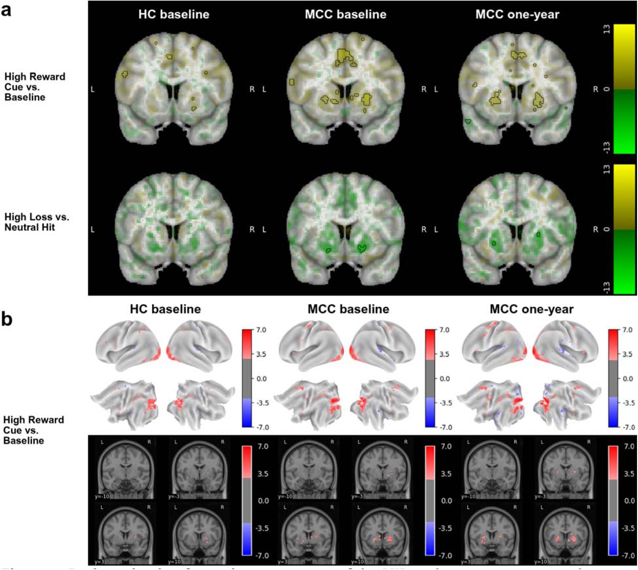 Brain activation for various contrasts of the MID task across groups and timepointsThe HC group at baseline (n=23), the MCC group at baseline (n=35), and the MCC group at one-year (n=40; except High Loss vs. Neutral Hit: n=39) did not show activation differences between the two groups at baseline or between the two time points of the MCC group. Cannabis use frequency changes were not associated with brain activation at one-year. Figure 2a: Voxel-wise average brain activation, colored by effect size and opacity-scaled by z-scores with significance threshold (FDR=0.05) outlined, for the high reward cue vs. baseline contrast (top row) and the high loss vs. neutral hit feedback contrast (bottom row) of the MID task. z-thresholds: HC group at baseline=3.37 (top) and undetermined (bottom), MCC group at baseline=3.24 (top) and 4.34 (bottom), and MCC at one-year=3.10 (top) and 4.65 (bottom). Note that activation for the other contrasts was below threshold. Colorbar displays effect size. Undetermined z-threshold indicates that no voxel was statistically significant. Figure 2b: Grayordinate-wise average brain activation z-scores above significance threshold (FDR=0.05) for the high reward cue vs. baseline contrast of the MID task. z-thresholds: HC group at baseline=2.91, MCC group at baseline=2.74, and MCC at one-year=2.70. Note that activation for the other contrasts was below threshold. Colorbar displays z-scores. HC=healthy control; MCC=medical cannabis card.