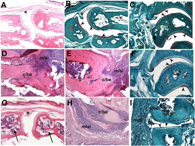 Histology of Δ8-THC effects in the mouse CIA model. (A,B) Metatarsal-phalangeal joint from a control (no CIA) mouse stained with (A) H&E and (B) Safranin-O/FG showing normal thin appearance of synovium (*) and robust proteoglycan-positive chondrocytes in the articular cartilage (arrowheads in B). (C) Tibia-talus-calcaneus joints from a positive control mouse (CIA + dex); the synovium is multi-layered but free of macrophage infiltration, and the articular cartilage stains robustly with Safranin-O (arrowheads). (D) Metatarsal-phalangeal and (E) tibia-talus joints from two different CIA mice stained with H&E; note extensive macrophage synovial infiltration (m/si) and cartilage/bone erosion (c/be). (F) Tibia-talus and (G) metatarsal-phalangeal joints from two different CIA mice treated with 30 mg/kg Δ8-THC (high dose); in (F), only scattered macrophages are present in the synovium (*) and the articular cartilage stains robustly with Safranin-O (arrowheads): compare with the control tibia-talus joint in (C); in (G) there is moderate loss of periosteal/trabecular bone (long arrows) but no macrophages are present in the synovium (*): compare with the control joint in (A). (H,I) Metatarsal-phalangeal and calcaneus-cuboid joints from two different CIA mice treated with 3 mg/kg Δ8-THC (low dose); in both feet, note the extensive macrophage synovial infiltration (m/si) and cartilage/bone erosion (c/be); and in (I) note the extensive loss of proteoglycan staining from the articular cartilage (arrowheads). Magnification ×100. Scale bar = 1.0 mm.