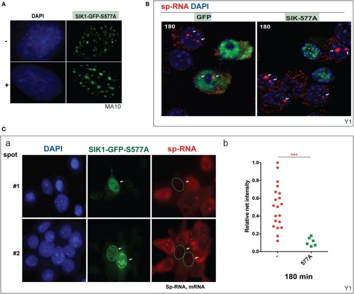 Inhibition of basal and induced expression of StAR by PKA-resistant SIK1–S577A–GFP. (A) Nuclear location of SIK1–S577A–GFP with and without Br-cAMP. (B) Suppression of Br-cAMP induction (180 min) of StAR RNA at the loci or in the cytoplasm in cells that transfected with SIK1–S577A–GFP versus GFP. (C) Quantitative expression in transfected Y-1 cells versus neighboring untransfected cells (a, image #1 and image #2). Associated mRNA intensity in 20 transfected cells versus 6 adjacent untransfected cells (b).