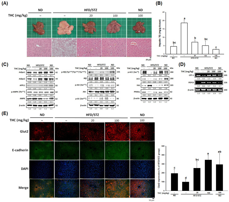 Amelioration of hepatic steatosis and by THC in HFD/STZ treated mice. (A) Macroscopic appearance (upper) and H&E staining (lower) of liver tissue. (B) Serum level of hepatic TG content was measured in each group (n = 6). (C) AdipoR-APPL1 signaling, insulin signaling, lipogenesis and PPARα protein level in the liver was detected by Western blot analysis. (D) Hepatic mRNA levels of CPT-1 and PEPCK was analyzed by RT-PCR. The data of Western blot and PCR shown are representative of three independent experiments with similar results. (E) Immunofluorescence staining with hepatic Glut2 (red), E-cadherin (green), and DAPI (blue). Quantitative data of immunostaining was performed by ImageJ (n = 5). Data are presented as mean ± SEM (n = 5–6). Statistical differences (p < 0.05) between groups were evaluated by one-way ANOVA with Tukey’s post-hoc test and were labeled as different letters (a, b, and c).