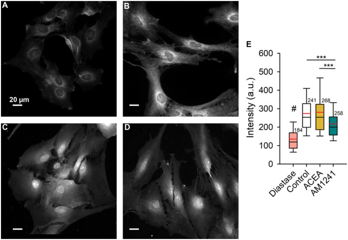 Activation with ACEA (CB1R ligand) and AM1241 (CB2R‐biased ligand) of glycogen labeled astrocytes. Astrocytes stained with periodic acid‐Schiff (PAS) were treated with (A) diastase (fixed and permeabilized cells) or pretreated with (B) control extracellular solution (3 mM glucose), (C) 1 μM ACEA (CB1R agonist), and (D) 1 μM A M1241 (CB2R‐biased ligand). (E) Quantitative analysis revealed that all treatments differed significantly from the diastase condition (#p ≤ 0.001). In addition, AM1241‐treated cells exhibited a significant reduction in glycogen content compared with both the control and ACEA‐treated cells (***p ≤ 0.001). Micrographs were acquired using a 20× objective; white scale bars, 20 μm.