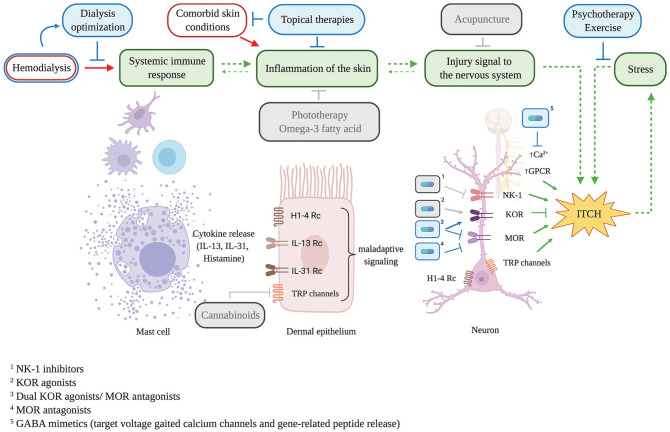 Uremic pruritus pathophysiology and management strategies. Hemodialysis may lead to the development of uremic pruritus in a mechanism that involves mast cell activation, maladaptive dermal cell signaling and the induction of the itch sensation via various nociceptive receptors within the peripheral and central nervous systems. Current (blue) and prospective (grey) uremic pruritus management strategies target various junctures of this mechanism, including receptors identified as itch modulators, which can be targeted by systemic pharmacological means (capsules; sharp-ended arrow = activation, flat-ended arrow = inhibition).Note. Ca = calcium; GPCR = G protein-coupled receptor; NK-1 = neurokinin-1; KOR = κ-opioid receptor; MOR = μ-opioid receptors; TRP = transient receptor potential; GABA = gamma-aminobutyric acid.