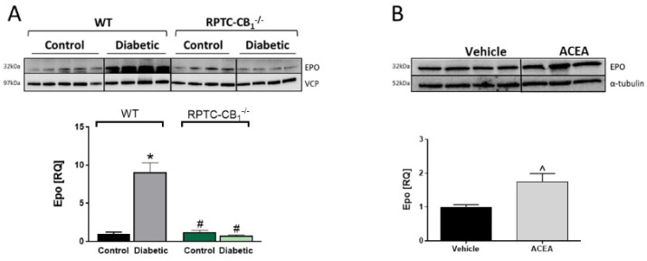 Renal EPO levels are elevated during diabetes or by activation of CB1R. Representative Western blots and quantification of the protein levels of EPO in kidney samples collected from normal and diabetic WT and RPTC-CB1−/− mice (A), representative Western blots and quantification of renal protein levels of EPO in mice treated acutely with arachidonyl-2′-chloroethylamide (ACEA) (10 mg/kg, IP; B). Data represent the mean ± SEM from 8–13 animals per group, * p < 0.05 vs. non-diabetic control WT mice, # p < 0.05 vs. diabetic WT mice, ^ p < 0.05 vs. vehicle-treated mice.