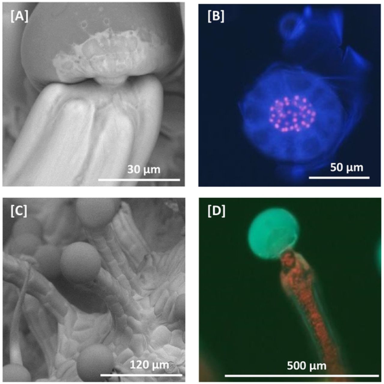 Scanning electron microscopy and fluorescent microscopy of C. sativa trichomes SEM micrograph of a capitate-stalked glandular trichome. Glandular trichome heads are morphologically distinct from the associated multicellular stalk. Glandular trichome heads are attached to multi-cellular stalks by a narrow constriction of the stalk. [B] Fluorescent microscopy image of a glandular trichome head showing the stipe cells (red fluorescence) that subtend the discoid layer of disc cells (no red fluorescence) at 400-440 nm excitation. Remnants of the ruptured cuticular layer covering the glandular cavity are visible on the right and top. Chlorophyll autofluorescence in red [C] SEM micrograph of capitate-stalked glandular trichomes, showing apparent continuity between epidermal layer and stalk. [D] Fluorescent microscopy image of capitate-stalked glandular trichome at 400-440 nm excitation with gland intact. Secondary metabolites in the glandular trichome head fluoresce blue, when excited, while chlorophyll in chloroplasts fluoresces red.