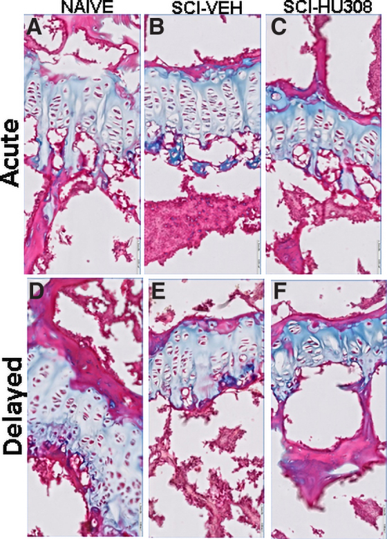 Representative histological staining of the growth plate from decalcified proximal tibiae in both treatment paradigms. Photomicrographs of Goldner's stain from acute treatment (A) naïve, (B) SCI-VEH, and (C) SCI-HU308 animals, and delayed treatment (D) naïve, (E) SCI-VEH, and (F) SCI-HU308 animals. Bar represents 50 μm. SCI, spinal cord injury; VEH, in vehicle.