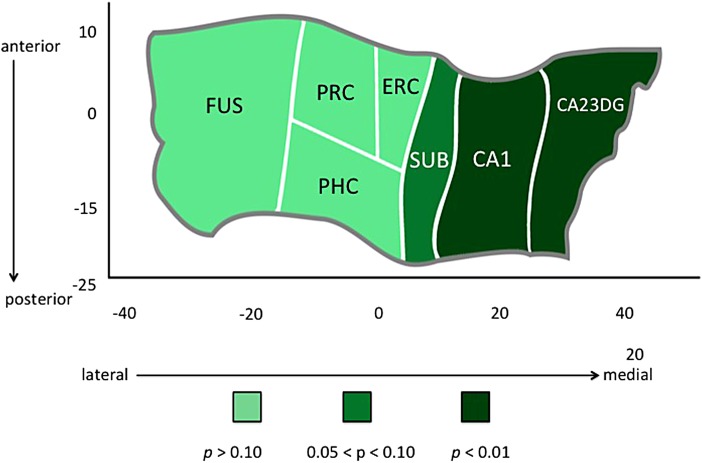 Hippocampal complex unfolding reveals relationship between CB use and subregional hippocampal morphology in late life. A cortical unfolding procedure was used to produce a flat map of the hippocampal complex. Regions are color coded according to the strength of the statistical association between CB group and cortical thickness in individual subregions within the hippocampus and surrounding neocortex. CB, cannabis.
