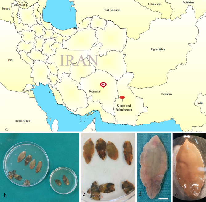 (a) Geographical description of the patient’s location in the Sistan and Baluchestan province, southeastern Iran (red pin) and Afzalipour Medical Center in Kerman (red H symbol). (b-e) Adult worms of Fasciola hepatica extracted from distal parts of the common bile duct of a 42-year-old female patient. scale bar: 5 mm