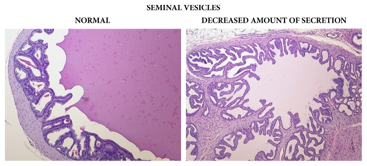 Seminal vesicles: comparison of normal (control) tissue to tissue from a male from the 3000/4000 mg/kg bw/day group showing decreased amount of secretion, 14-day study.