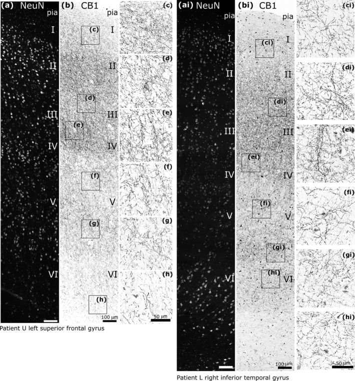 Distribution of strongly CB1 receptor immunoreactive axons and boutons in the human cerebral cortex. (a, ai) Confocal microscopic immunofluorescence images showing NeuN‐positive neurons in layers I–VI in two cortical areas. (b, bi) Inverse contrast, immunofluorescence laser scanning images of the same cortical areas demonstrating different densities of strongly CB1‐positive axons; framed areas are shown at higher magnification in (c–h, ci–hi). In some layers, radial axon bundles are apparent. Z stacks of optical slices total thickness (a, b, 16 μm; ai, 8 μm; bi 6.7 μm), (c, ci–h, hi, 6–10 μm). Scale bars: (a, ai, b, bi) 100 μm; (c–h, ci–hi) 50 μm.