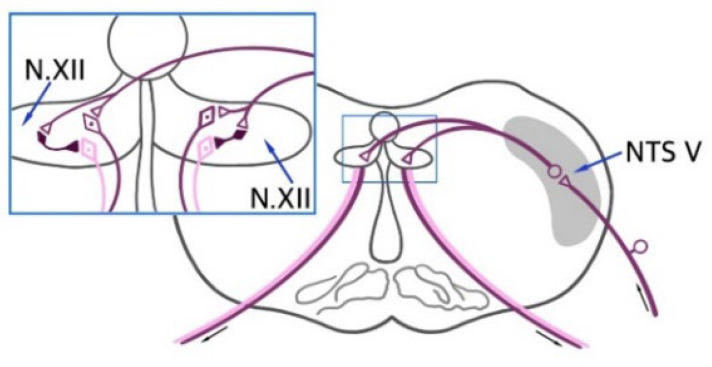 A scheme of the trigemino-hypoglossal reflex arc. In trigemino-hypoglossal reflexes, such as tongue jerks (ETJ) evoked by tooth pulp stimulation, the impulsation from n.V sensory nuclei was transferred to the ipsi- and contralateral hypoglossal nerve nucleus, where it stimulated the motoneuron of the tongue-withdrawing muscles, and the excitation of the inhibitory interneuron caused the inhibition of the tongue-protrusion-muscles motoneuron. NTS V—n.V spinal tract nucleus; N.XII—hypoglossal nerve nucleus; light-colored triangle—the excitatory synapse, dark triangle—the inhibitory synapse.