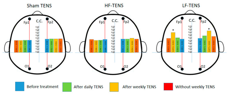 Dynamics interhemispheric coefficient coherence (C.C.) between frontal (Fp1-cлeвa and Fp2-cпpaвa) and occipital (O1-cлeвa and O2-cпpaвa) regions of alpha rhythm before and after treatment in all study groups. Notes: LF-TENS: low-frequency, high-amplitude transcutaneous electrical nerve stimulation; HF-TENS: high-frequency, low-amplitude transcutaneous electrical nerve stimulation; * p ≤ 0.05.