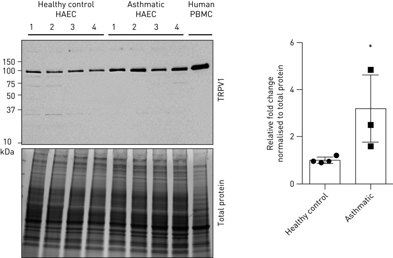 TRPV1 protein is elevated in human airway epithelial cells (HAECs) from people with asthma. Immunoblot of HAECs from healthy subjects (n=4), people with asthma (n=4) and peripheral blood mononuclear cell (PBMCs) (control) were analysed for TRPV1 and quantified as fold change over healthy subjects, normalised to total protein loading. *: p<0.05.
