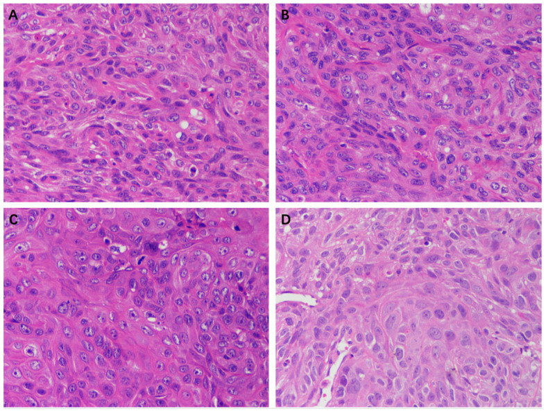 HE staining of tumors in nude mice of different groups (400×). (A) Control group, (B) Solvent control group, (C) 50 mg/kg EEP group, and (D) 100 mg/kg EEP.