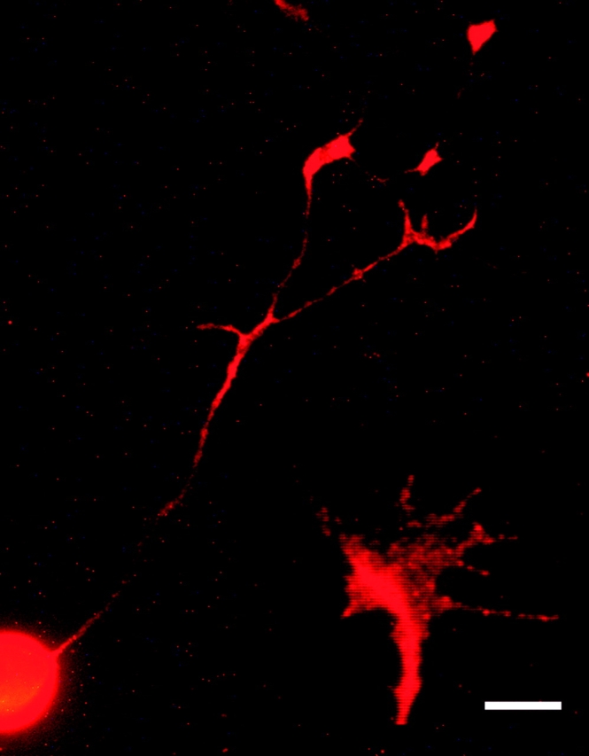 CB1 receptor expression on cerebellar neurons. Cerebellar neurons were cultured overnight in media containing 5 ng/ml FGF2 before being fixed and stained for the CB1 receptor (see Materials and methods). The above picture shows a representative example of a stained cerebellar neuron. The inset shows an individual growth cone at higher magnification. The bar is 10 μm relative to the larger image, and 5 μm relative to the inset. No staining was seen when the primary antibody was omitted.