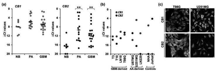 Expression of cannabinoid receptors type 1 (CB1) and 2 (CB2) in tumor samples, and tumor-derived and established human glioblastoma cell cultures. The levels of CB1 and CB2 mRNA were analyzed by quantitative RT-PCR (a) in tumor biopsies from benign juvenile pilocytic astrocytomas (PA, WHO grade I, n = 14) and highly malignant glioblastomas (GBM, WHO grade IV, n = 21), as well as in normal human brain samples (NB, n = 8, two of the RNA samples being pooled from multiple donors); and (b) in human glioblastoma primary cultures: T3 and T10, and established cell lines: T98G, U251MG, U87MG, LN229; GBM—glioblastoma multiforme-derived; AA—anaplastic astrocytoma-derived cell line; normal human astrocytes (NHA) and Jurkat cells (human T-cell lymphoblastic leukemia cells). Results are presented as ∆Ct values (Ct of a target gene—Ct of a reference GAPDH gene). For tumor biopsies each individual sample is plotted and a mean in each group is marked with a horizontal line; for cell lines the values correspond to means from two independent preparations in duplicate. (c) Representative micrographs showing differential CB1 and CB2 expression in T98G and U251MG cells. The presence of CB1 and CB2 receptors was studied at the protein level by immunocytochemistry and confocal microscopy; original magnification 200×. Statistical significance of differences in gene expression in PA and GBM samples as compared to NB was determined using ANOVA and is indicated as follows: ** p < 0.01.