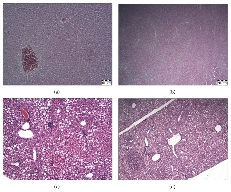 The effect of HF diet on histopathological changes in the liver. HE-stained preparations were sectioned with blade thickness of 5 μm and analyzed and photographed using a combined photobinocular light microscope Olympus BX51. (a) Control with normal liver histology /10x/; (b) rimonabant treated control chow diet fed group with normal liver histology /10x/; (c) liver histology in HF group shows mild steatosis with portal inflammatory infiltrate and focal necrotic changes in parenchyma /20x/; (d) liver histology in HFR group shows mild steatosis /10x/.