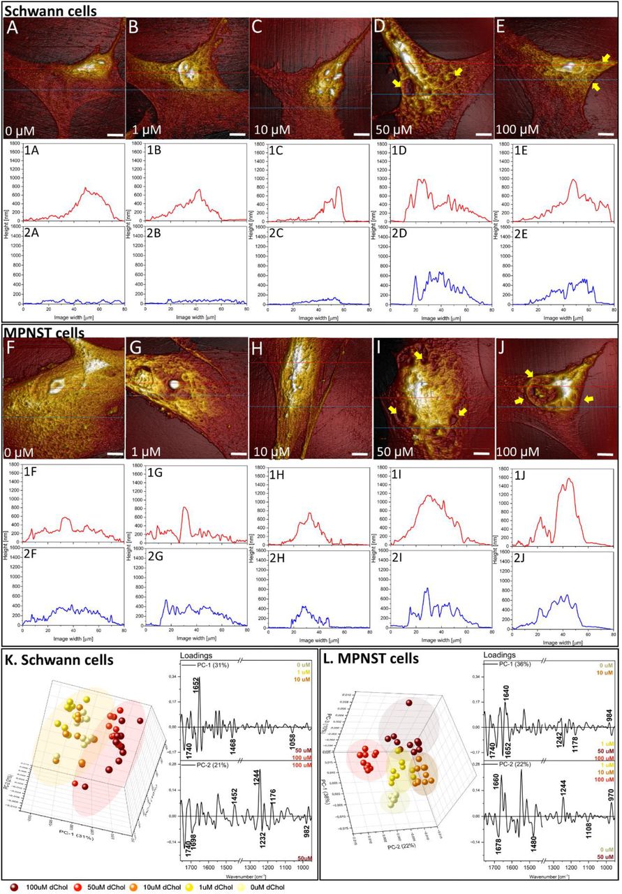 Representation of 3D AFM topography maps for Schwann (A-E) and MPNST (F-J) treated with 0 µM, 1 µM, 10 µM, 50 µM, and 100 µM concentrations of d6-cholesterol. Scale bar equals 10µm. Height profiles correspond to cross-sections through the nuclear (red trace) and cytoplasmic (blue trace) regions were presented (1A-1E). Principal component analysis (PCA) was applied to AFM-IR spectra to identify factors associated with d6-cholesterol treatment beyond conventional C–D vibration region (K, L).