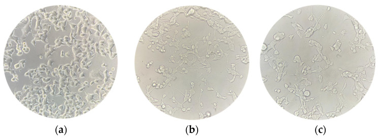NSC-34 cell cultures were captured at three different timepoints to evaluate changes in their morphology. (a) Undifferentiated NSC-34 cells; (b) differentiated NSC-34 cells; (c) differentiated NSC-34 cells treated for 24 h with 20 μM CBN. Scale bar = 20 μm, 40× magnification.
