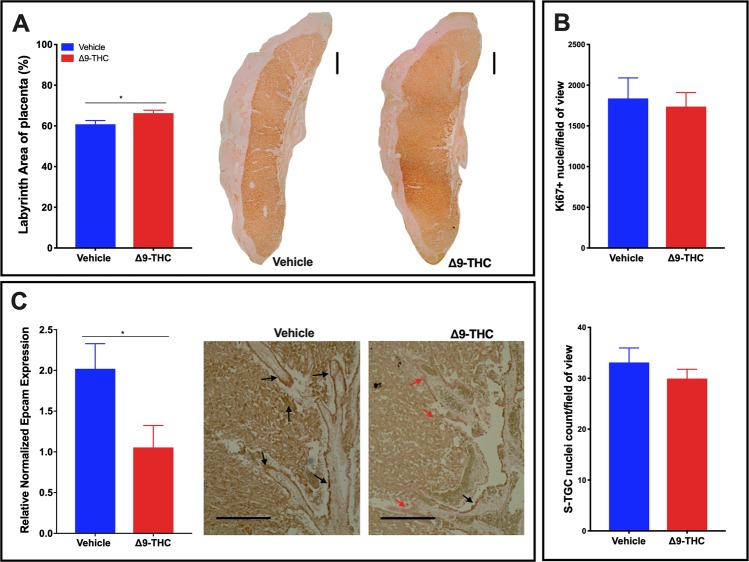 Exposure to 3 mg/kg Δ9-THC during gestation leads to increased labyrinth layer area at E19.5 compared to vehicle treatment, however with no associated increases in cell proliferation nor number of S-TGCs. (A) Percentage of labyrinth layer area of total placenta and representative images showing Iso-Lectin B4 staining in labyrinth. (B) Analysis of numbers of Ki67+ nuclei and S-TGC nuclei in the labyrinth layer. (C) Quantification of Epcam mRNA in rat placenta at E19.5 by qPCR (graph) and assessment of EPCAM protein expression by IHC in labyrinth layer. For labyrinth area, 6-images/placenta were taken at 10×, while for Ki67, S-TGC and Epcam assessment, 6-images/placenta were taken at 40×. Graphs present mean ± SEM. Significance; Student’s t-test (*P < 0.05). Scale bars = 500 uM in (A), 150 uM in (C).