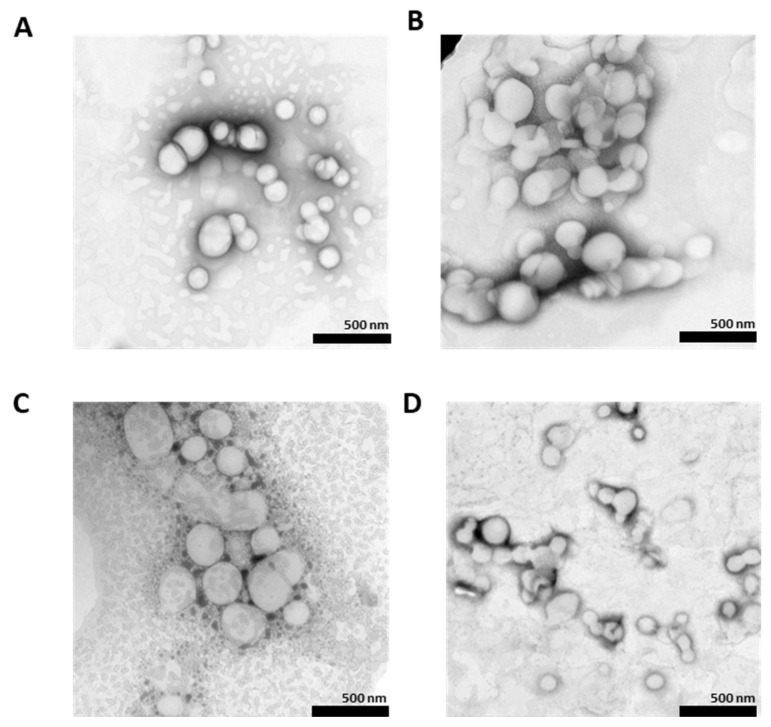 Negative staining TEM images of (A) (CBD-NLC1), (B) (CBD-NLC2), (C) (CBD-NLC3), and (D) (CBD-NLC4) at ×10,000 magnification.